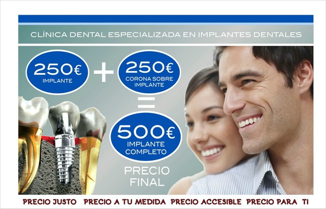 Precios de implantologia dental